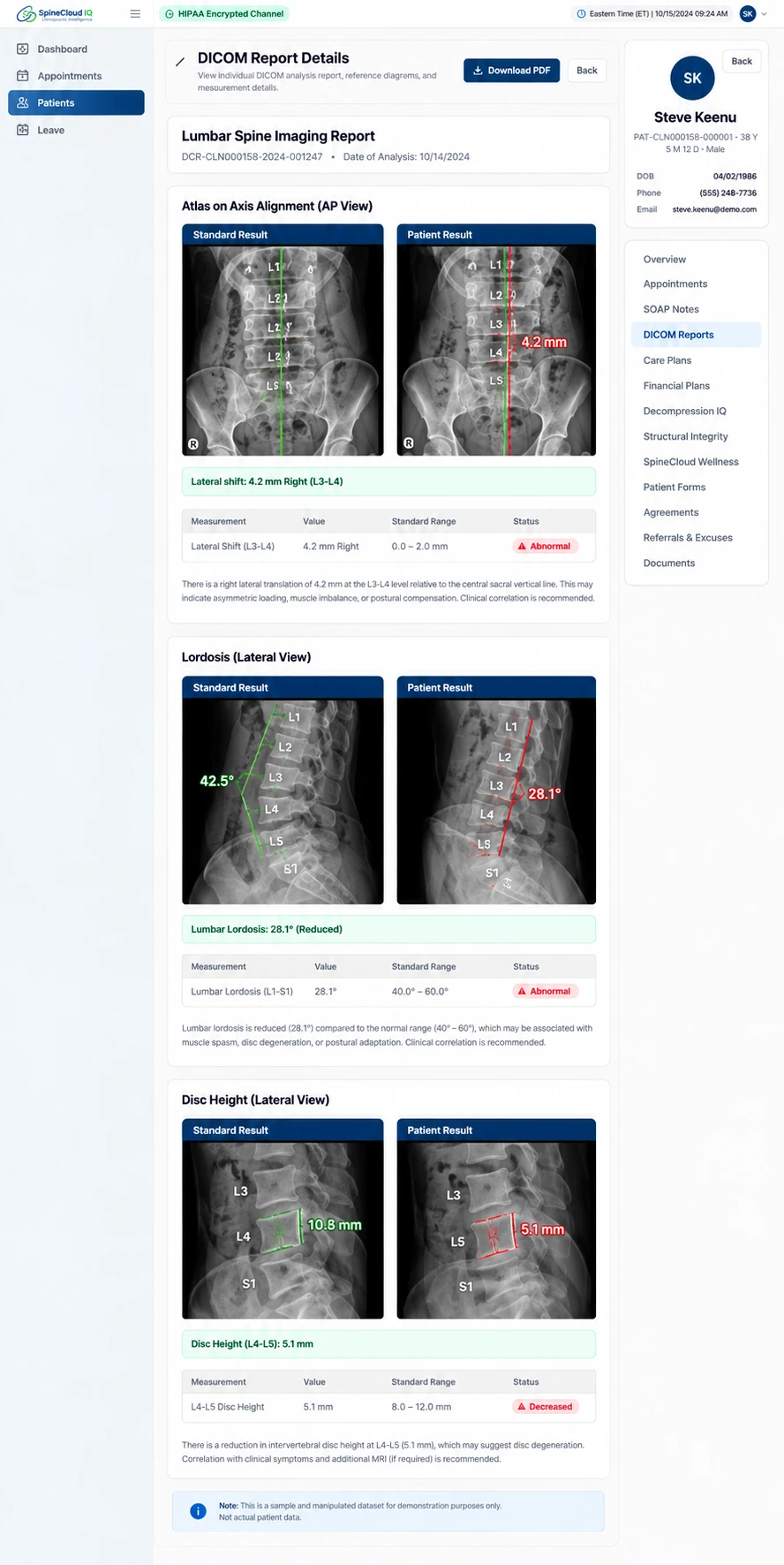 DICOM & Spine Analysis in the SpineCloudIQ clinical workspace